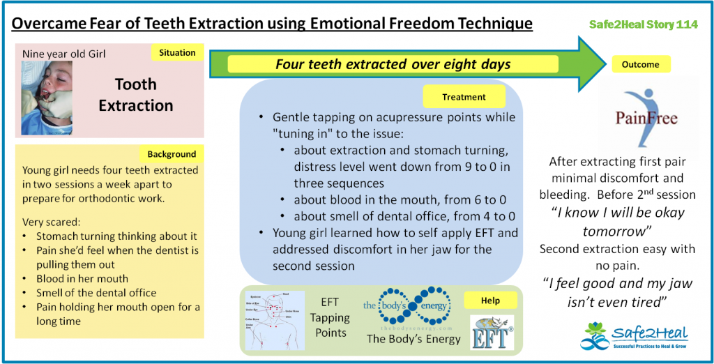 S2HStory114: Overcame Fear of Teeth Extraction using Emotional Freedom Technique